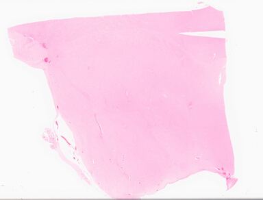 ['deident_f08e30c3-08a7-465c-89ad-c10231601a1f_69d96967.jpg']