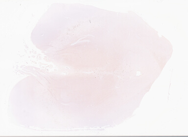 ['deident_badba243-b204-43db-bcd0-a18861e03712_69d96954.jpg']