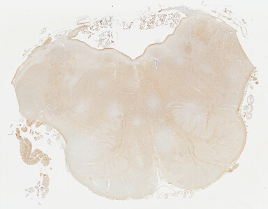['deident_f5914801-dab0-4047-9fee-a0336e50c834_69b031f2.jpg']