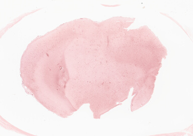 ['deident_1c352b45-9b6a-4a84-bed5-608f4bb7e2d0_695fc34e.jpg']