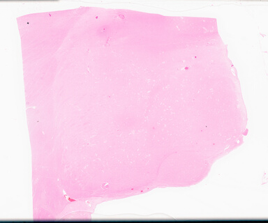 ['deident_16f93863-c0d0-45e7-bdf8-a0d010ec2131_69d95941.jpg']