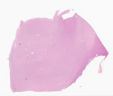 ['deident_0f883e14-d56f-4fd6-9214-de068bdb11f9_69d9400c.jpg']