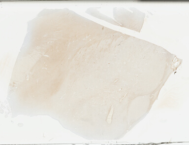 ['deident_341567ed-76a8-4abd-b53c-59f8cdc2b36c_69b04a25.jpg']