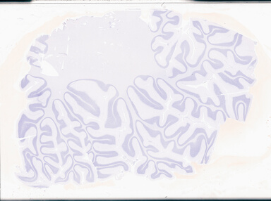 ['deident_cf050a0f-f85f-4258-b82d-f9c6281ae842_69b02f2a.jpg']