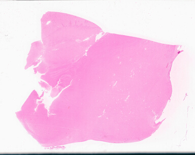 ['deident_3b1af6fd-f0c4-4bc0-a8ff-6c6cae8d357b_69b02ec7.jpg']