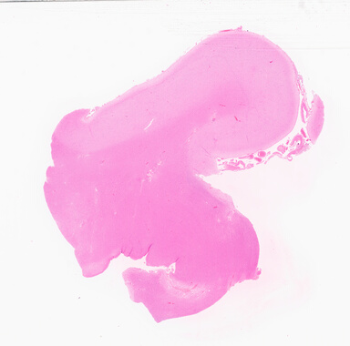 ['deident_14eb1a1e-7361-4246-a704-e20a511e9656_69b02ea1.jpg']