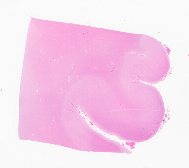 ['deident_933fc8e6-b368-4955-8eea-5761842defa2_69d9526e.jpg']