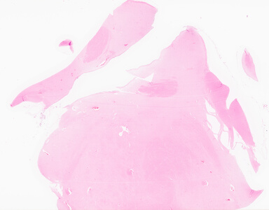 ['deident_0c92dd1b-3fe3-4197-afb7-14932d59801b_69d95f08.jpg']