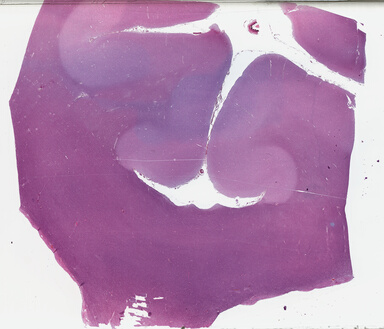 ['deident_107a2ace-5e8d-425b-9a30-bc0af2b2835e_69b03bc9.jpg']