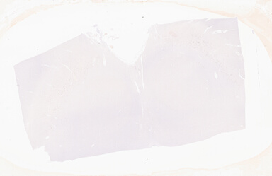 ['deident_4cf57b7d-5251-4722-8da7-206f27180cb8_69b059d6.jpg']