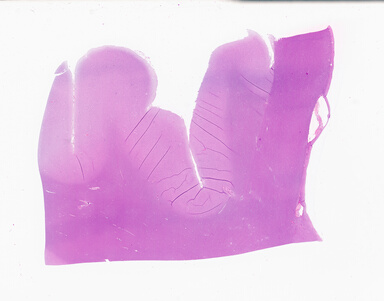 ['deident_5efe04e6-3d5a-494c-93ad-e9ddc84413b5_69b059e4.jpg']