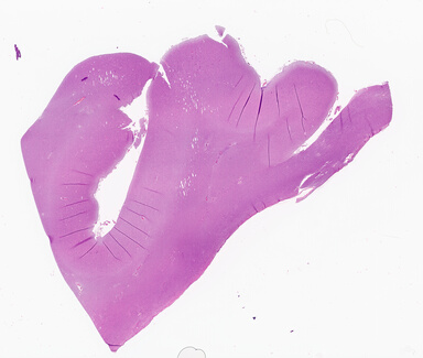 ['deident_fdeb3512-7f71-4b50-bb5a-4aa2d0734538_69d944e3.jpg']
