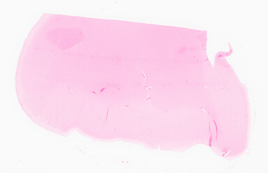 ['deident_7ca008c7-321f-4637-862c-0c65856a2677_69d9640a.jpg']