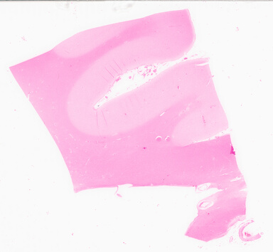 ['deident_3517b840-07f9-45e5-b856-3da28ac06425_69d9543d.jpg']