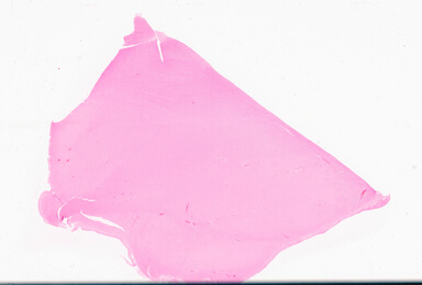 ['deident_04d1ba36-3b4d-4fbf-92ae-04bc552ea65f_69d94e7b.jpg']