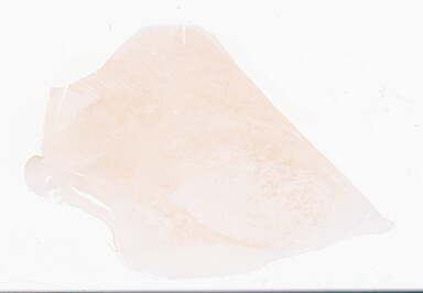 ['deident_2a68195f-7e54-4b29-bae4-1dae294316ce_69d94e97.jpg']