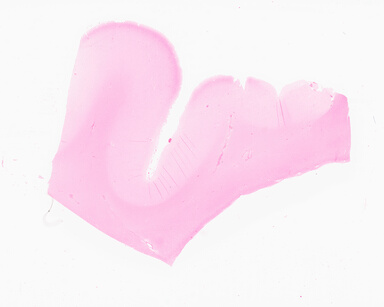 ['deident_ee65d019-6be7-4e4d-a1e6-be364c767c22_69d94eef.jpg']