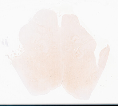 ['deident_a49f9d25-52ee-4e6d-8d87-ecbcda7ab956_69d94ecd.jpg']