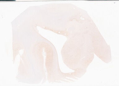 ['deident_8343b192-95aa-4d97-b364-c71bb7ce2101_69b053e7.jpg']
