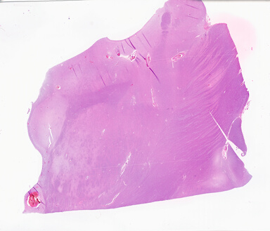 ['deident_df00bbee-0355-4f26-a699-95d4fb663917_69d9507c.jpg']