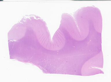['deident_55b050d1-94b1-4f3f-8d69-5a5783b67432_69b0520f.jpg']
