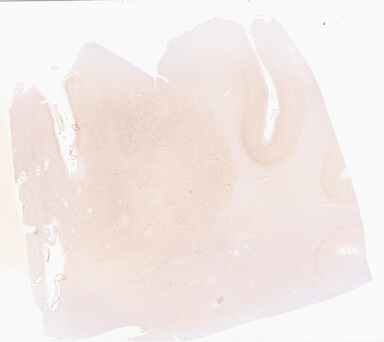 ['deident_e3583211-0505-4313-bd2f-d54f1a226dd4_69b04fdc.jpg']