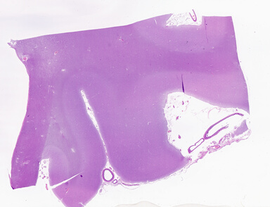 ['deident_5df6f6a7-7c07-4ca4-a719-4fb411a01f3c_69b04fa9.jpg']