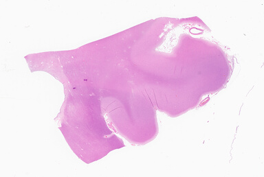 ['deident_8a10d59b-fece-4fd8-ae59-53f19f522d97_69d9259e.jpg']