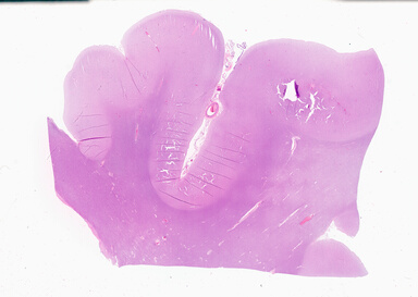 ['deident_3d697af1-3061-4268-98e0-eefdee9226e4_69b05d86.jpg']