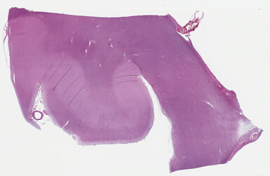 ['deident_161a99de-4e1a-44cf-ad21-89d4730c8470_69b04406.jpg']