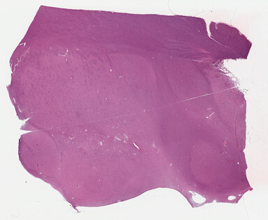 ['deident_a18c6e89-e25e-491d-be90-79269c6e6033_695fcc14.jpg']