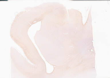 ['deident_60ca7a6d-d1e7-4aeb-8851-cf7ac063123e_69b058dd.jpg']
