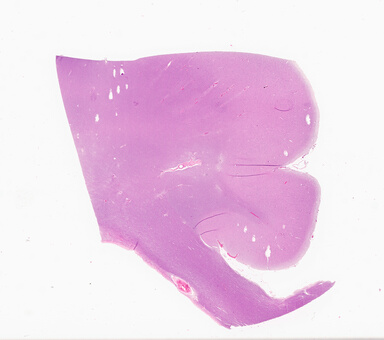 ['deident_ec61f42b-3340-4829-87ae-d3ad8915e10a_69d936b9.jpg']