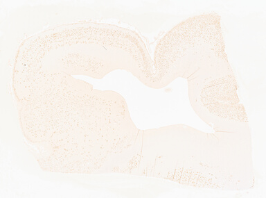 ['deident_0edd68ba-6e00-435f-93ee-b0973fc45cd4_69d93e3b.jpg']