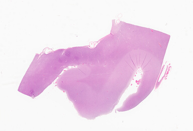 ['deident_a32e1e5f-d5c9-437d-aa31-be6d1ee9a22a_69d92f60.jpg']