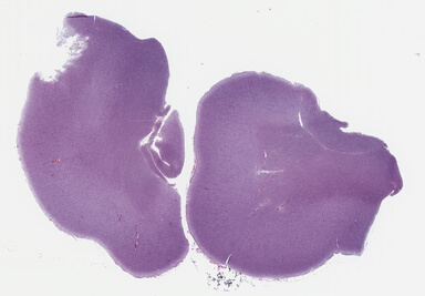 ['deident_c4cc2f16-c4e7-4538-8e74-8fb066687dcb_695fc4f9.jpg']