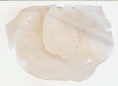 ['deident_6b9448ad-01bc-452f-9c47-28e7504ba340_695fc4da.jpg']