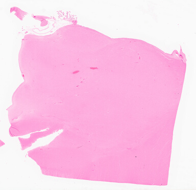 ['deident_e7cd115a-c848-441d-9f57-0d536395e46b_69d965c8.jpg']