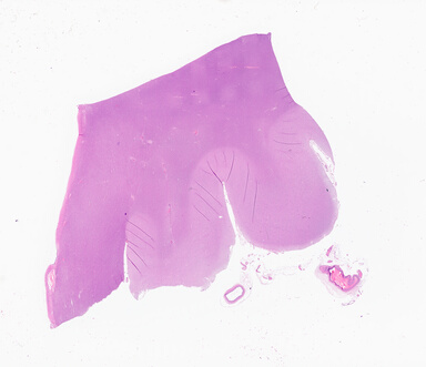 ['deident_ccb47ad9-5634-4e7e-a70b-5ee72f102acb_69b0620b.jpg']