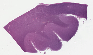 ['deident_818cacc9-15a7-44d2-84fb-51a940f52ec5_695fd4d8.jpg']