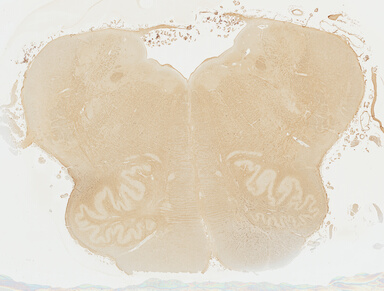 ['deident_ed57a91d-2ad2-4cf6-90ed-f209451987dd_695fd502.jpg']