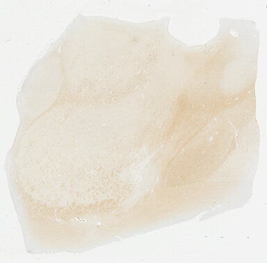 ['deident_902ce045-579b-441b-95a2-0197d087050c_695fd4db.jpg']
