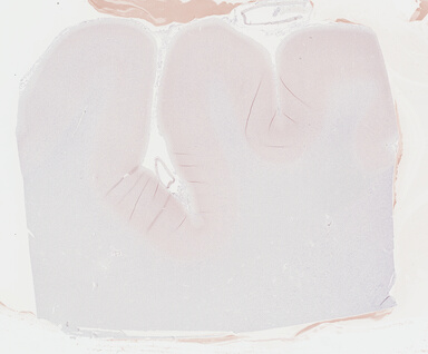 ['deident_11104843-f728-4b2e-977c-741df094ab30_69b040a3.jpg']
