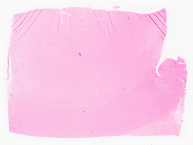 ['deident_5282448b-104a-47b2-ab6c-d090763da8ac_69d957ba.jpg']