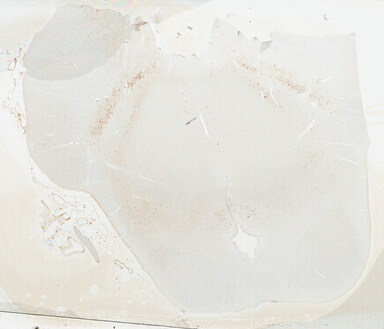 ['deident_e4a33fd8-270a-4893-85cd-b2646e04bd9e_695fcf9a.jpg']