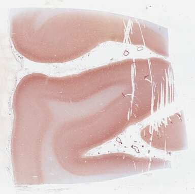 ['deident_bc30cb16-eabc-43a9-a1f8-6da2c43fbb3b_695fcf8a.jpg']