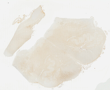['deident_cd7d8048-e3a2-47f5-8b6d-9c040bcfc142_69b035c5.jpg']