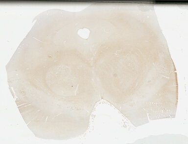 ['deident_d62c79cc-72f8-4835-b7a8-b46710742ee5_69b035cc.jpg']