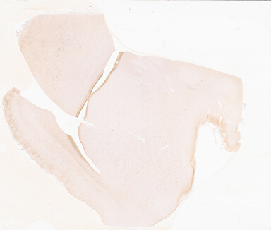 ['deident_f6edae06-c28a-4027-9822-88db1c0d5141_69b02ca0.jpg']