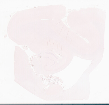 ['deident_e1259b8f-e269-4c34-a4dc-9ee3a3e0ed9d_69d93f16.jpg']